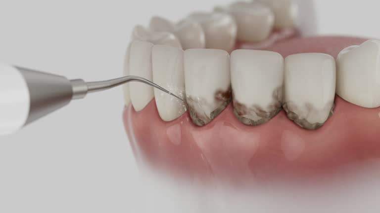Trusted Teeth Cleaning And Checkup service in Greenville, MS - Dentist Open Now